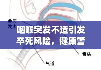 咽喉突发不适引发卒死风险，健康警钟长鸣！