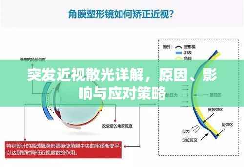 突发近视散光详解，原因、影响与应对策略