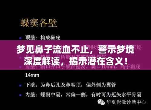 梦见鼻子流血不止，警示梦境深度解读，揭示潜在含义！