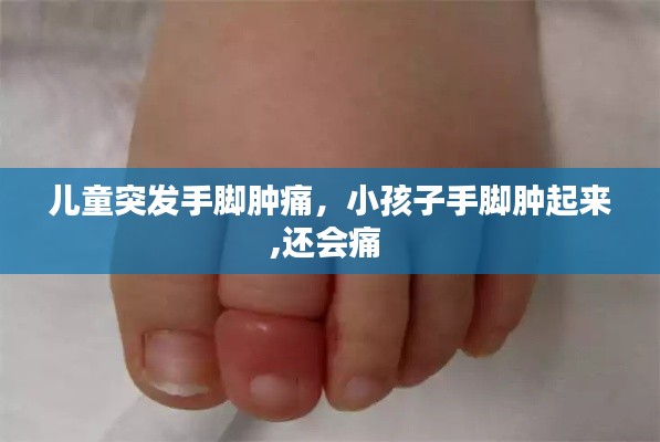 儿童突发手脚肿痛，小孩子手脚肿起来,还会痛 