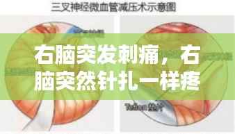 右脑突发刺痛，右脑突然针扎一样疼 