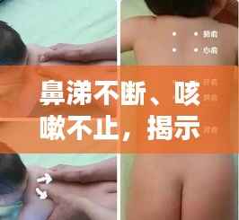 鼻涕不断、咳嗽不止，揭示症状背后的健康隐患